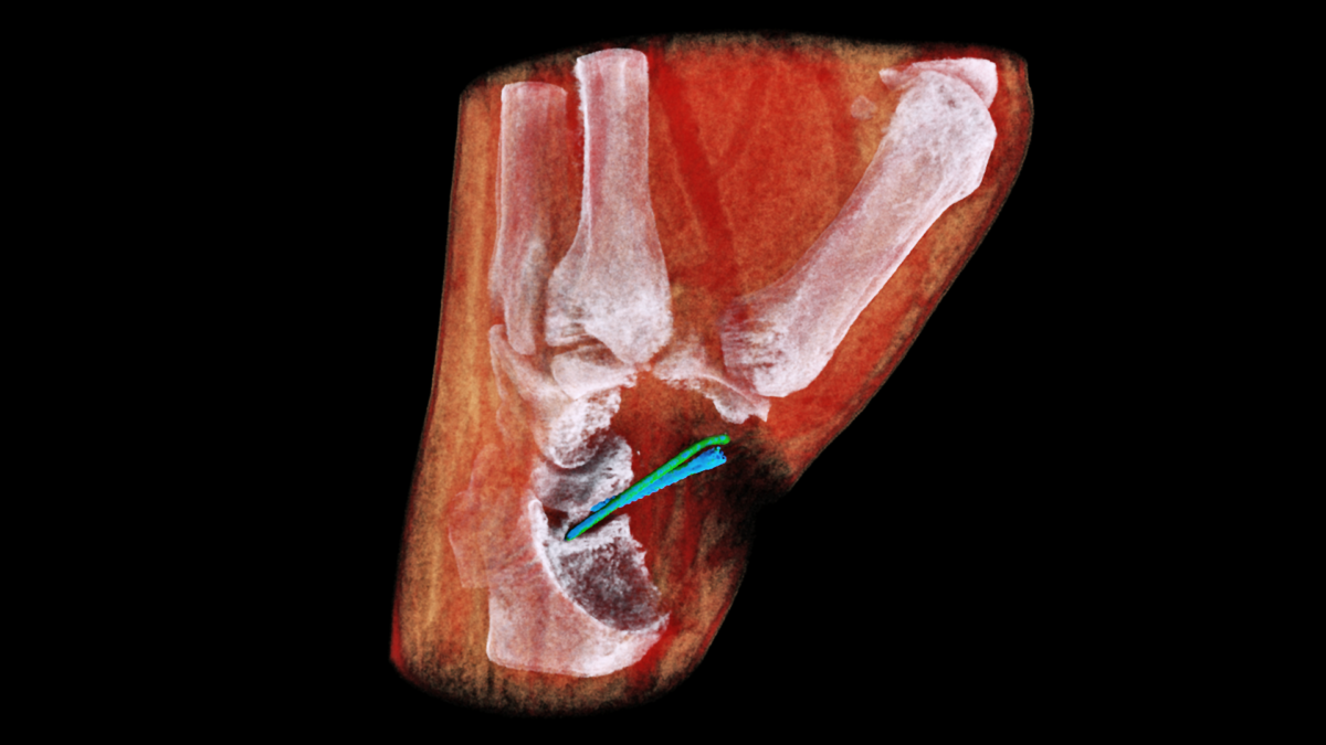 New 3D colour wrist X-ray