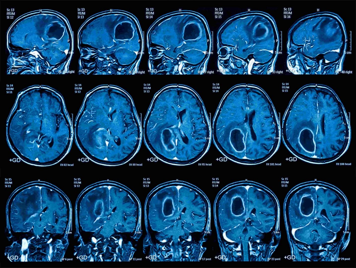 How the LHC could help us peek inside the human brain