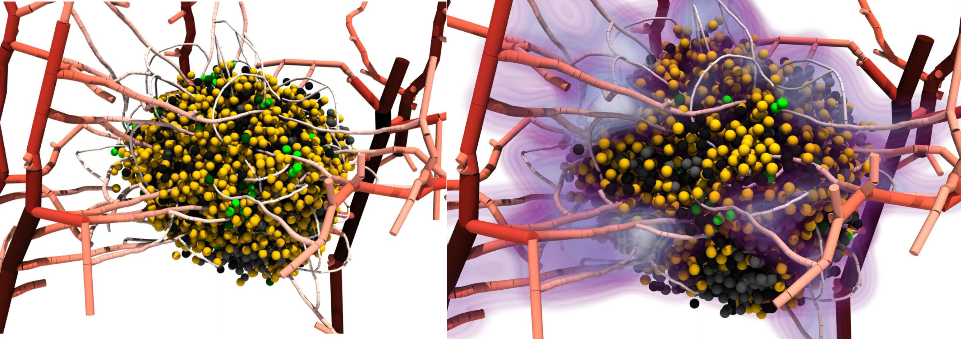 scientific image of two tumours, on the left it is before treatment. On the right, the tumour is surrounded by a purple glow reducing it. 