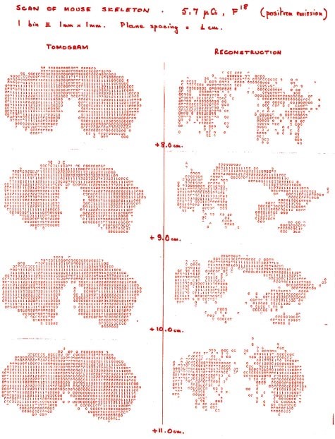 PET scan 1977